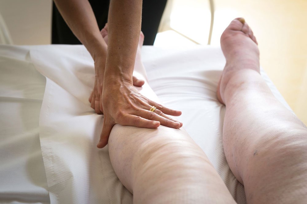 edema-treatment.jpg